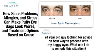 How to Get Rid of Puffy Eye Bags, and Factors that Can Make Swelling Under Eyes Worse