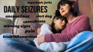 Grand Mal Seizure 20.3.22 Living With Seizures (Education Purposes)