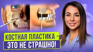 Всё о синус лифтинге! | Костная пластика верхней челюсти