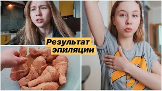 ЕСТЬ ЛИ РЕЗУЛЬТАТ ПОСЛЕ ПЕРВОЙ ЭПИЛЯЦИИ? 🤔 МОЙ РЕЦЕПТ КУРИНЫХ НОЖЕК 🍗 ЭТИ ДНИ ((