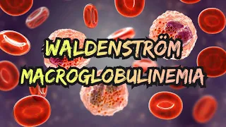 Waldenstrom Macroglobulinemia (updated 2023) - CRASH! Medical Review Series