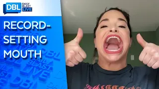 With 2.5-Inch Gape, Samantha Ramsdell Holds Guinness World Record for Biggest Mouth