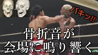 【顎粉砕】※閲覧注意 朝倉海vs佐々木憂流迦 顎が粉砕しても目は死んでない