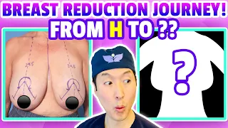 How She Went From an H Cup to a ?? One Woman's Breast Reduction Journey! - Dr. Anthony Youn