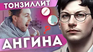 АНГИНА | Как вылечить хронический тонзиллит | Тонзилитные пробки как избавиться | Тонзиллит в горле