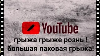 Огромная паховая грыжа . Оперативное лечение от первого лица. Детская хирургия. Ход операции.