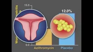 Post-Cesarean Infection and Antibiotic Prophylaxis | NEJM