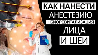 Как нанести анестезию + биоревитализация  лица и шеи