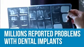 Dental Implants Expert Debunks Wild Claims - "Millions Reported Problems with Dental Implants