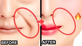 8mins SMILE LINES Facial Exercises (Nasolabial Folds) Lift Smile Wrinkles with this WORKOUT!