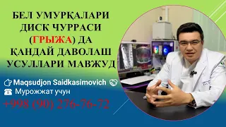 Диск чурраси (Грижа ) хакида гаплашамиз. Операция килиш керакми? Грижани кандай 99% аниклаш мумкин?