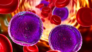 What is Leukemia and Lymphoma?