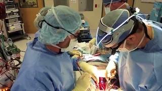 Life in the OR — Open Heart Surgery