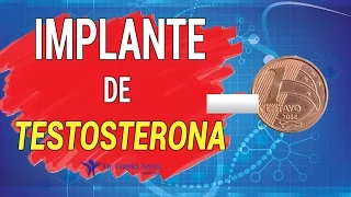 IMPLANTE DE TESTOSTERONA - Dr Gabriel Azzini