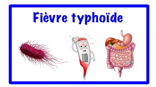 🔵fièvre typhoïde🌡