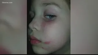 5-year-old girl attacked on school bus ride home