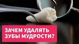 Зачем удалять зубы мудрости? Прямой эфир в Инстаграм