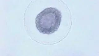 Amphioxus embryonic development