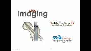 Skeletal fractures imaging (IV) (DRE) Prof. Mamdouh Mahfouz