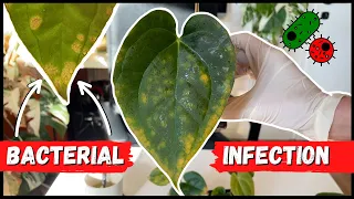 BACTERIAL INFECTION VS. FUNGAL // How to Recognize & Treat