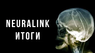 Чтение мыслей, стимуляция и управление мозгом [Neuralink]