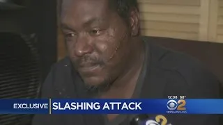 Exclusive: Slashing Victim Speaks Out