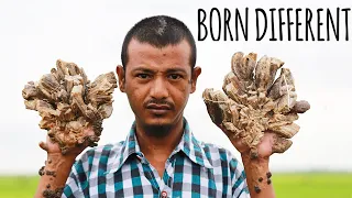 They Call Me 'The Tree Man' | BORN DIFFERENT