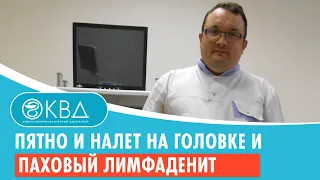 ↪ Пятно и налет на головке и паховый лимфаденит. Клинический случай №1004