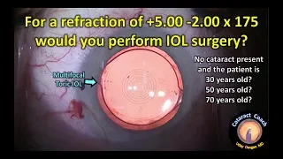 Patient age for multifocal IOL surgery: Age 30, 50, or 70. Which is best?