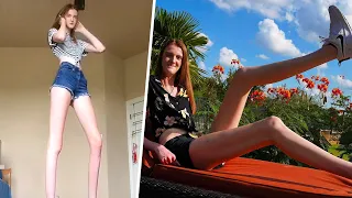 This 17-year-old girl has the world's longest legs! 😲