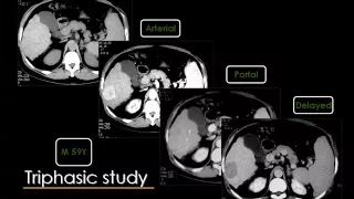 Hepatic imaging part I   Prof Dr  Mamdouh Mahfouz In Arabic