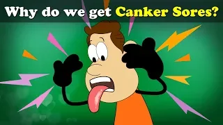 Why do we get Canker Sores (ulcers)? + more videos | #aumsum #kids #science #education #children