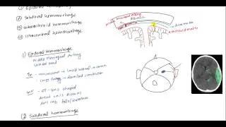 Epidural Hematoma, Subdural hematoma, Subarachnoid hematoma, Intracerebral hemorrhage