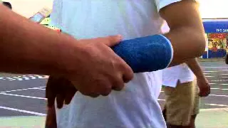 Street Healing: Broken Pinkie Finger with Pins, Hampton Beach 18 June 2014