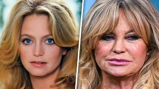 BOTCHED Surgeries That Left Celebrities Unrecognizable