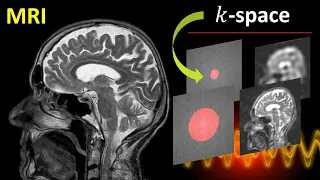 Basics of k-space for MRI (magnetic resonance imaging)