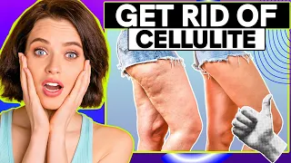 How to Reduce Cellulite: Tips, Exercises, and What Actually Works