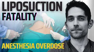 Why nurse died doing her own liposuction? (how to save anesthesia overdose)