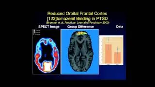 "Pharmacotherapy of PTSD" Webinar with Dr. John Krystal