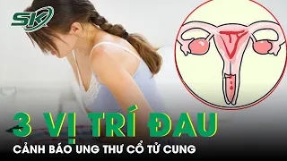 Ba Vị Trí Đau Cảnh Báo Ung Thư Cổ Tử Cung | SKĐS