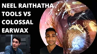 The Neel Raithatha Tools VS Colossal Earwax Blockage (First Impressions)