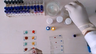 How to check Blood Group || Blood Grouping physiology practical