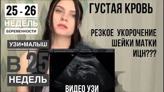 Моя беременность 25 - 26 недель УЗИ 🤰🏻РЕЗКО УКОРОТИЛАСЬ ШЕЙКА МАТКИ • ИЦН ? ГУСТАЯ КРОВЬ