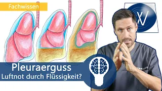 Pleuraerguss & Luftnot: Ursachen & Symptome für zuviel Flüssigkeit im Pleuraspalt | Medizinwissen