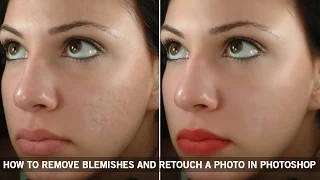 How to remove Blemishes and Photo retouching in Photoshop