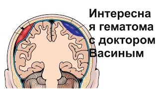 Интересная гематома с доктором Васиным