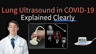 Lung Ultrasound in COVID 19: Findings, Accuracy, Pneumonia Diagnosis, Utility (POCUS)