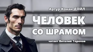 Артур Конан Дойл. Человек со шрамом.