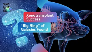 Xenotransplant Success“Big Ring” of Galaxies Found | Hugh Ross and Jeff Zweerink