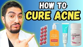 The ULTIMATE Acne Treatment Guide (2023)